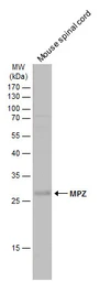 Anti-MPZ antibody used in Western Blot (WB). GTX134079